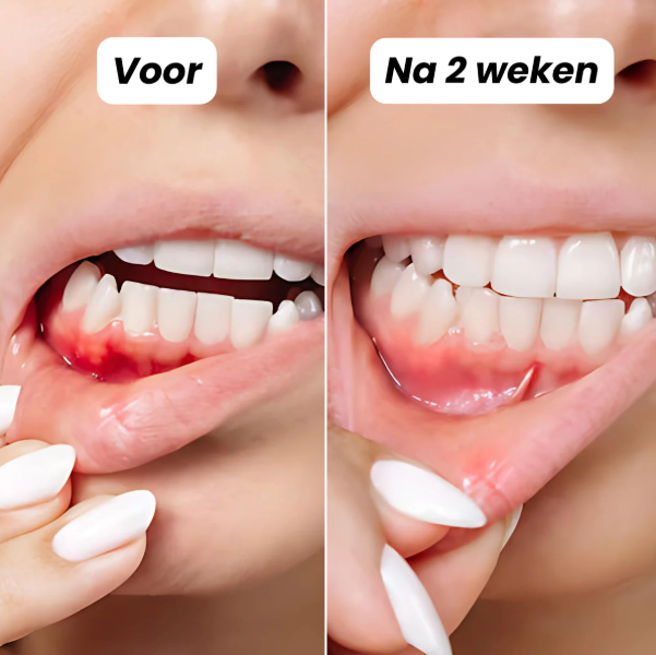 Draadloze Tandheelkundige Waterflosser